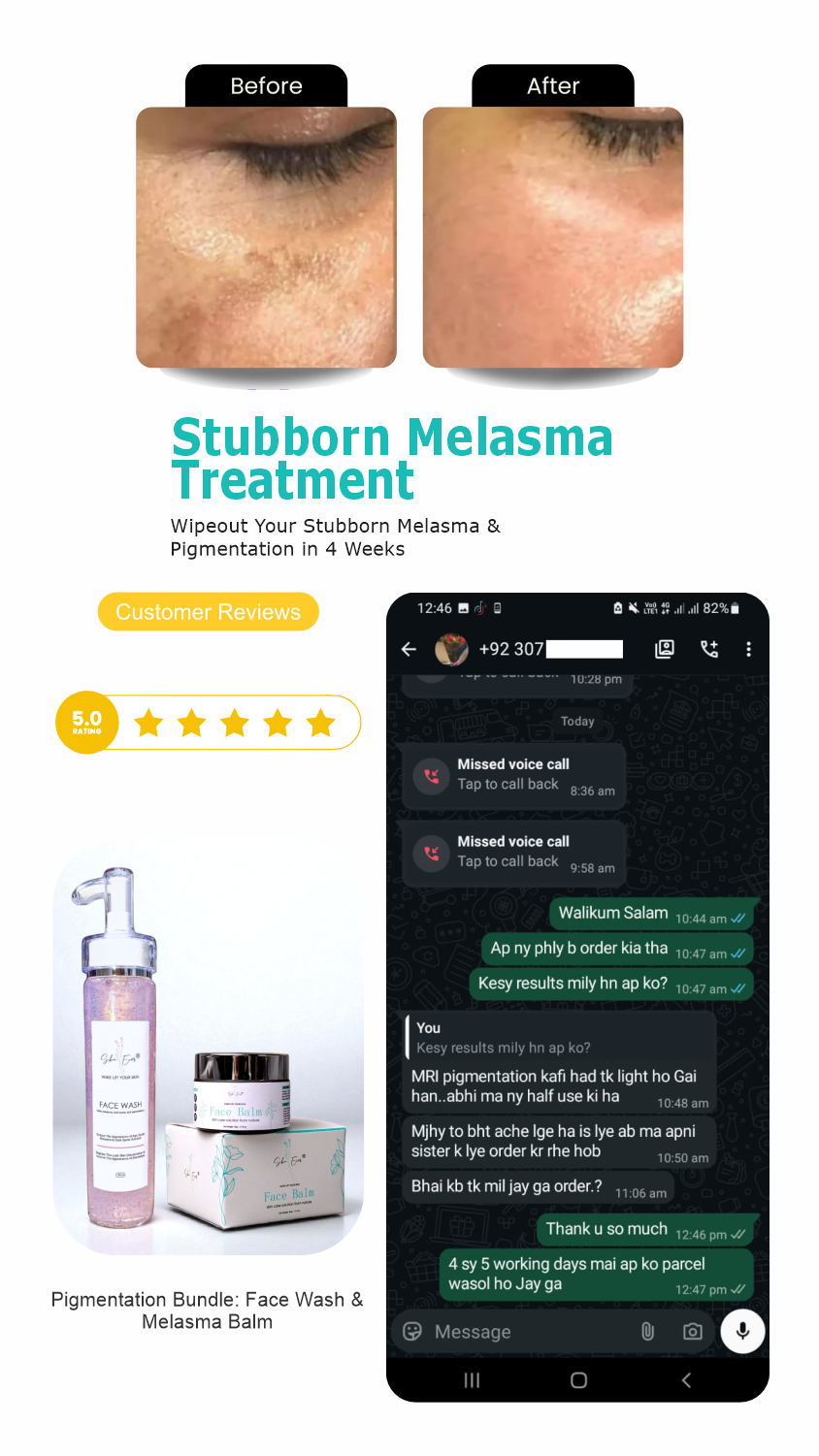 Pigmentation Bundle: Face Wash & Melasma Balm