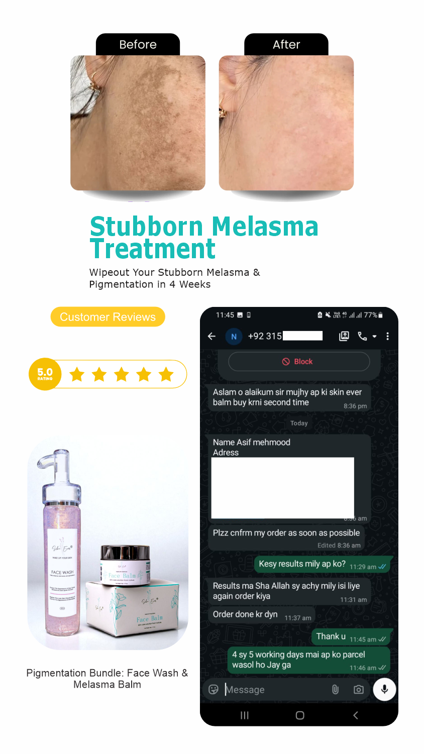 Pigmentation Bundle: Face Wash & Melasma Balm