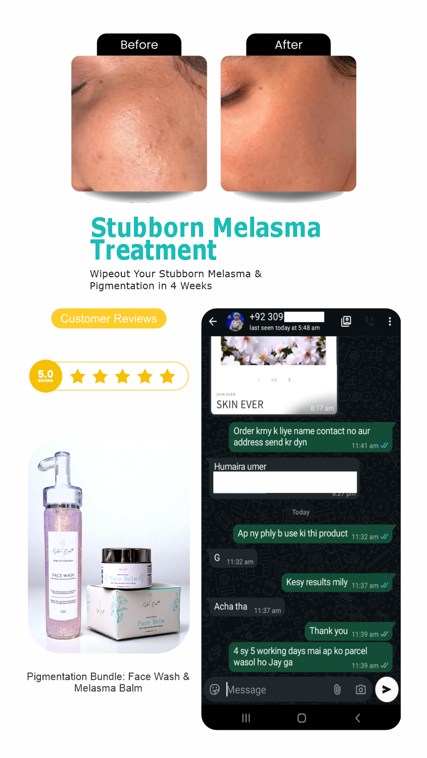 Pigmentation Bundle: Face Wash & Melasma Balm