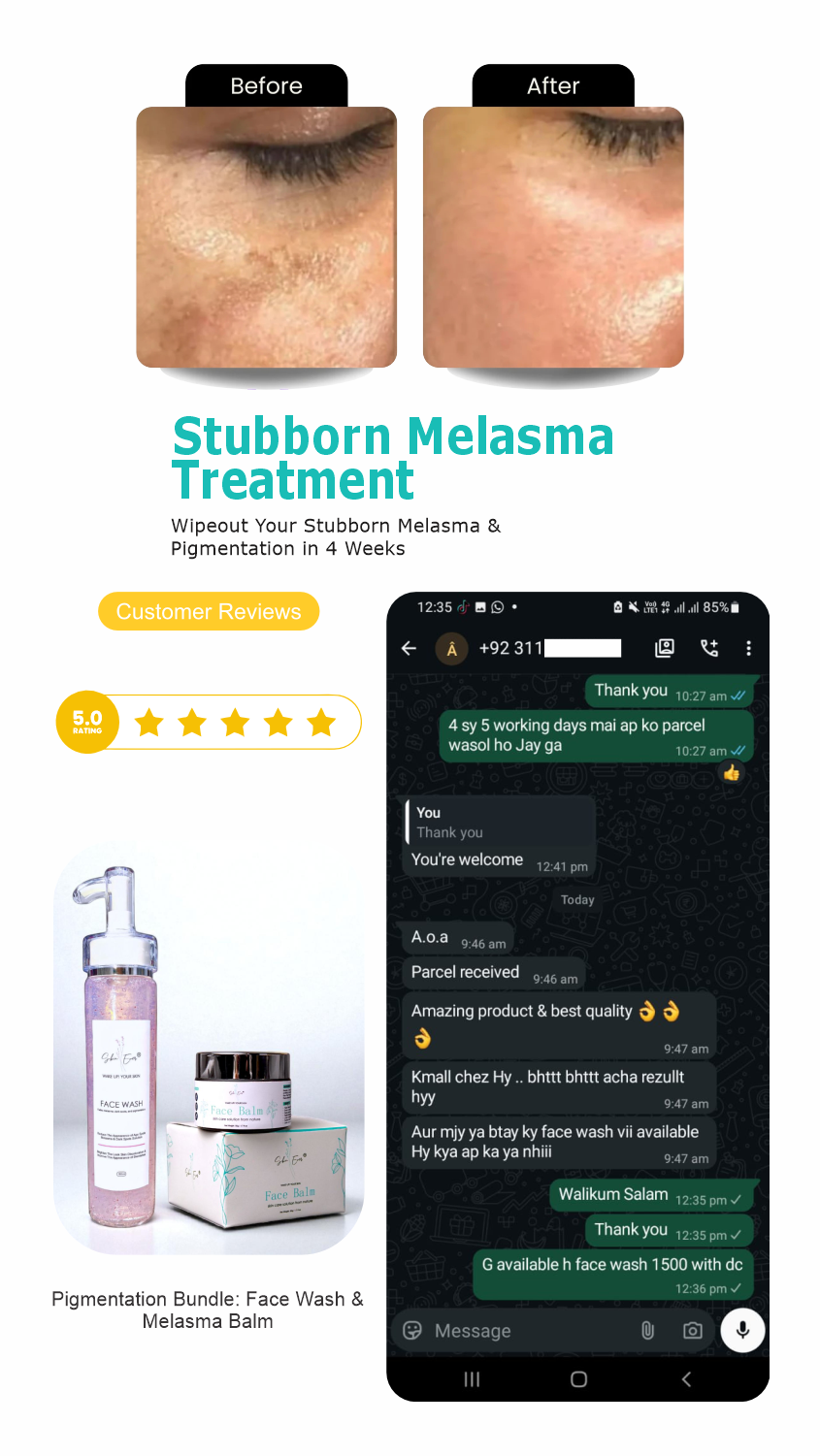 Pigmentation Bundle: Face Wash & Melasma Balm