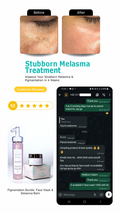 Face Balm For Melasma